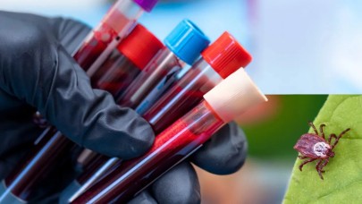 Yaz Aylarının Kabusu Kenelerin En Sevdiği Kan Grubu Belli Oldu! Uzmanlardan Dikkat Çağrısı…